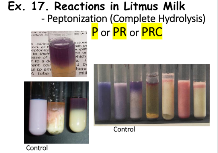 <ul><li><p><strong>Medium: </strong>Litmus Milk</p></li><li><p><strong>Substrate: </strong>Proteins: Casein & Lactalbumin</p></li><li><p><strong>Pathway/Enzyme:</strong></p><ul><li><p>Pathway: Peptonization (complete hydrolysis)</p></li></ul></li><li><p><strong>pH. Indicator/Reagents: </strong>Litmus Dye</p></li><li><p><strong>End Products:</strong></p><ul><li><p>Amino Acids <strong>OR</strong></p></li><li><p>Amino Acids + Rennet Curd</p></li></ul></li></ul><p></p>