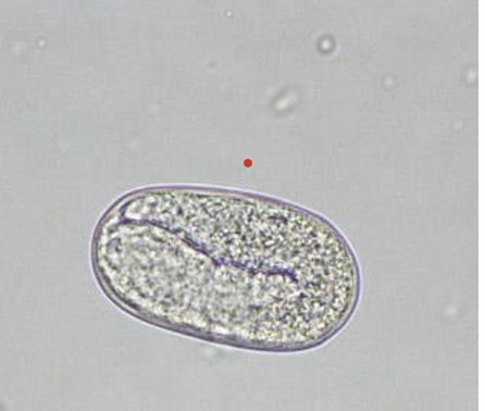 <p>ellipsoidal </p><p>smooth surface</p><p>thin shelled</p><p>contain fully formed larva when pased in feces</p>