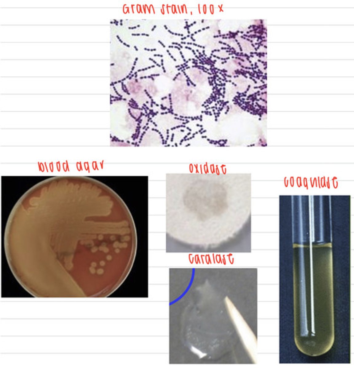 <p>a human goes to the doctor and has septicemia and meningitis. We take samples, and isolate them on non-enriched media (no growth), blood agar, and MacConkey agar (no growth). we also stain using the gram method and perform oxidase, catalase, and coagulase tests. Here are the results.</p><p>What is the diagnosis?</p>