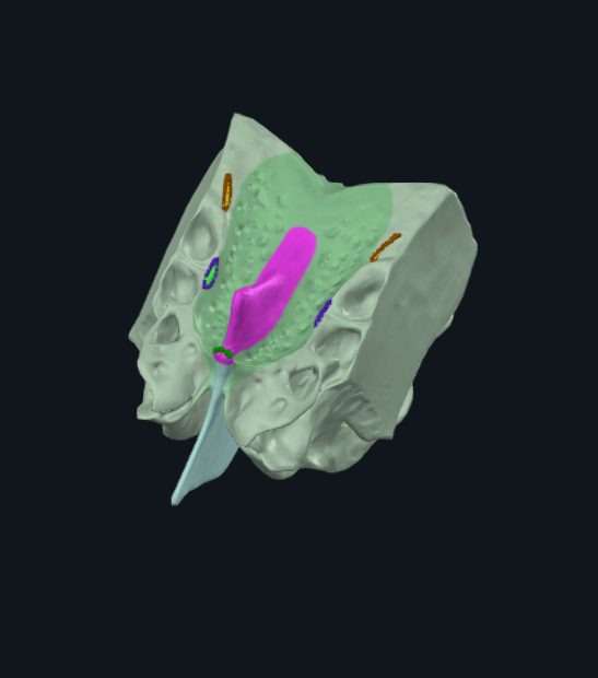 <p>What is highlighted in pink</p>