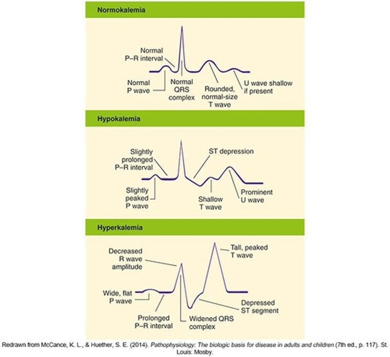 <p>ECG changes can indicate alterations in potassium, magnesium, or calcium levels, which can lead to serious complications.</p>