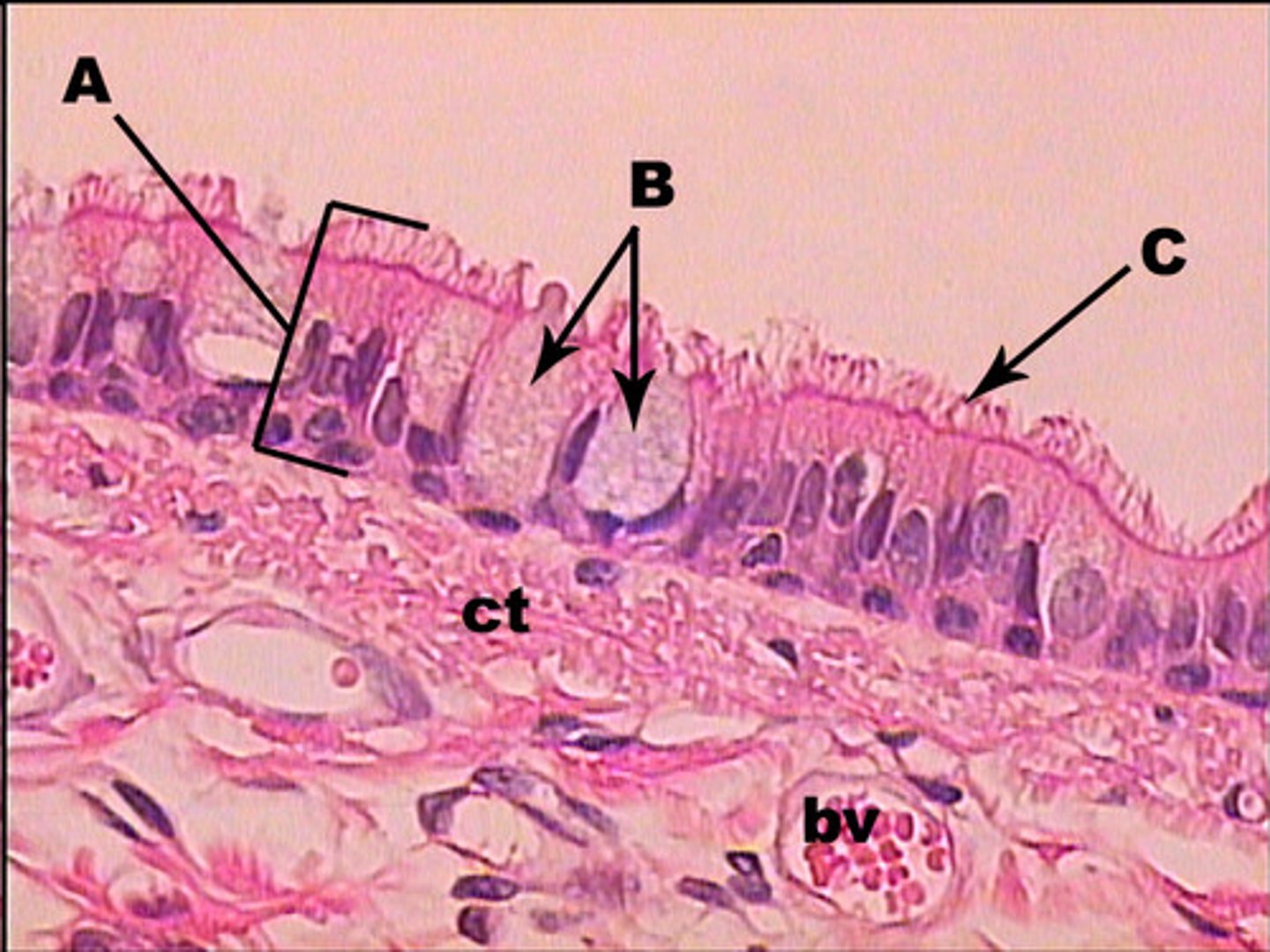 <p>single layer of irregular shaped cells (different heights)</p><p>nuclei are at different levels</p><p>found in lower pharynx, trachea, primary bronchi</p>