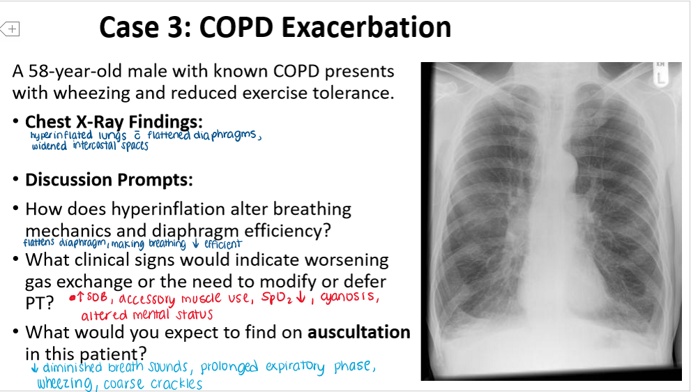 <p>COPD</p>