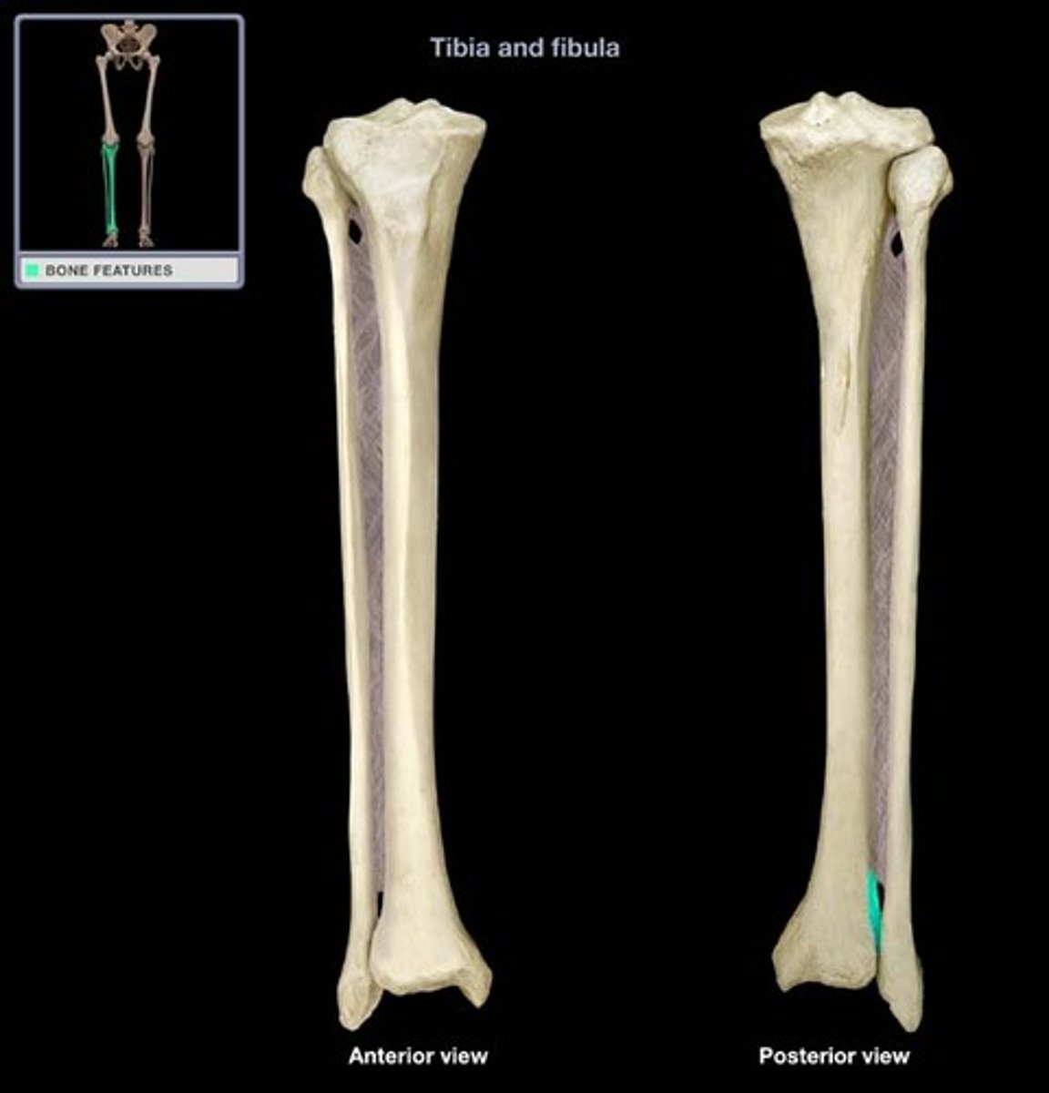 <p>lateral notch on the distal end tibia where tibia and fibula articulate</p>