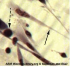 <p>Which type of virus does CPE detect cytoplasmic <strong>stranding arrow</strong> and nuclear inclusion bodies (dashed arrow)</p>