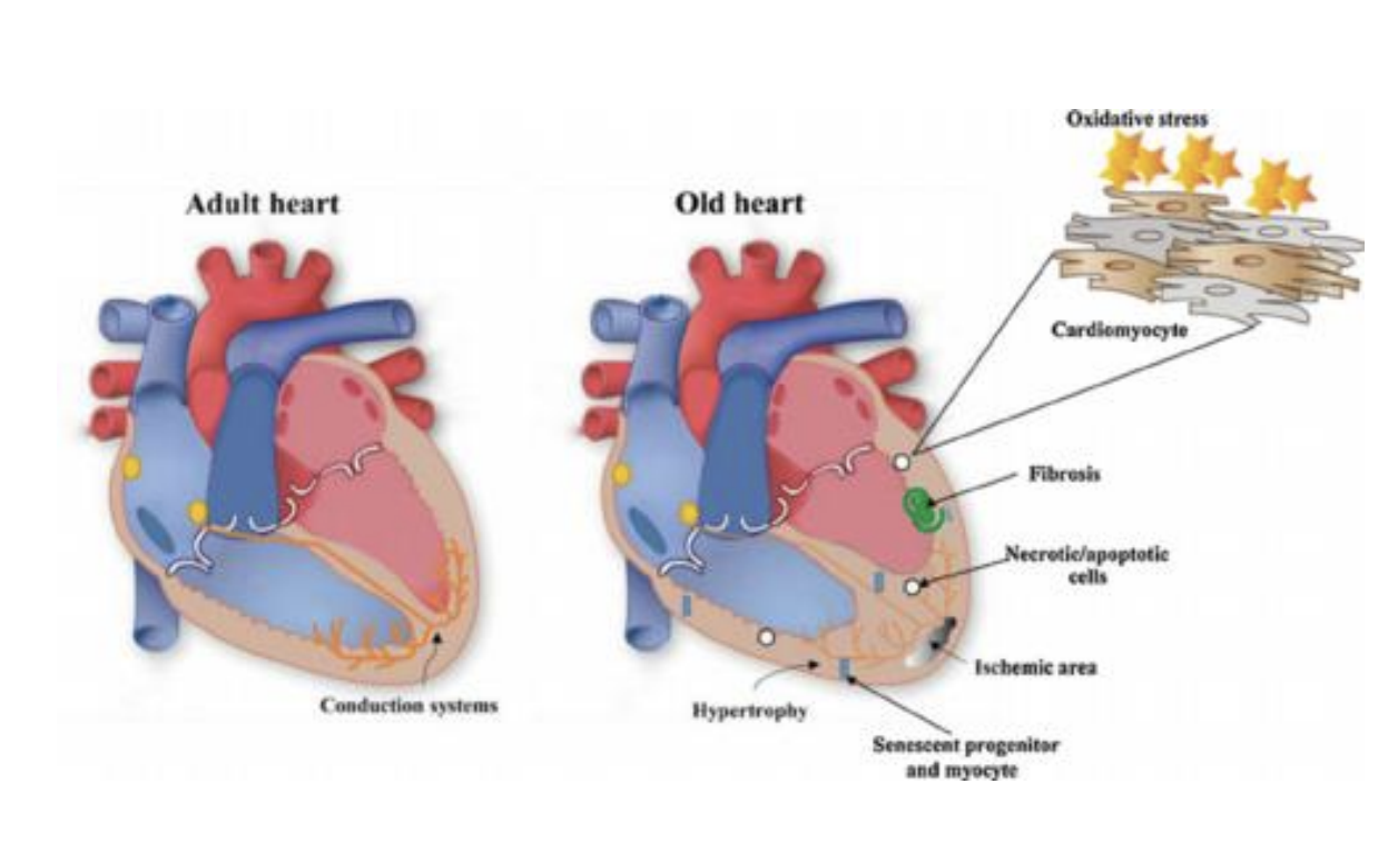 <ul><li><p>Structural changes to the heart</p></li><li><p>Changes in electrical conduction system</p></li><li><p>Decrease in maximal heart rate</p><ul><li><p>Changes in ability of heart to meet demands</p></li><li><p>Leads to decreased ability to oxygenate which leads to fatigue and decreased endurance</p><ul><li><p>—&gt; exercises should look different older adults </p></li></ul></li></ul></li><li><p>Changes in blood vessels</p><ul><li><p>Increased resistance makes heart work harder</p></li><li><p>Increased systolic BP</p></li></ul></li></ul><p></p>