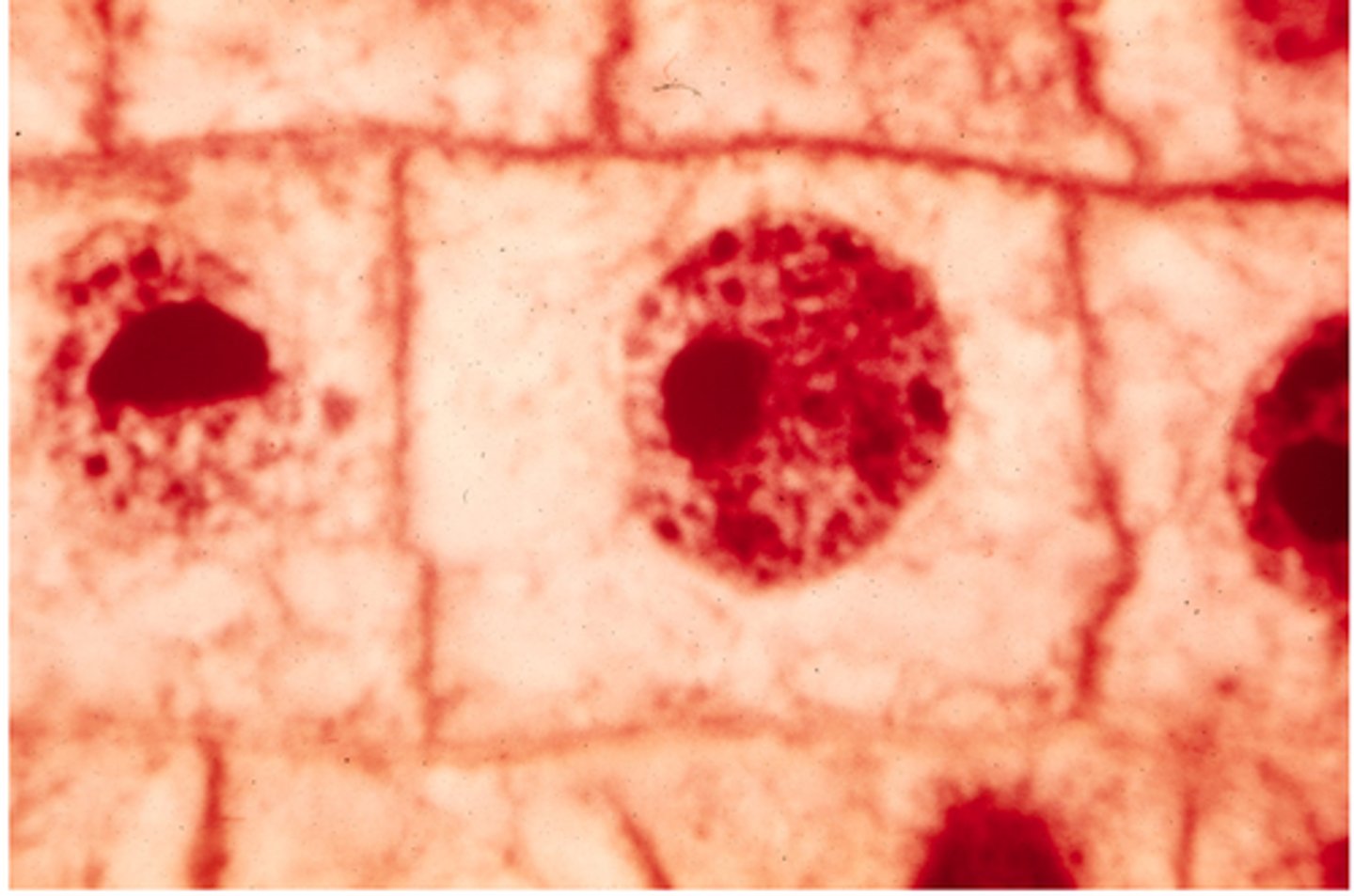 <p>This shows _______ in onion cells.</p>