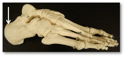 <p>Heel bone</p>