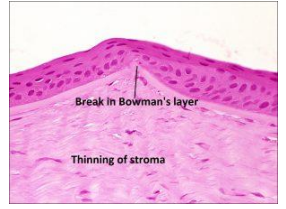 <ul><li><p>bowmans </p></li><li><p>70%</p></li></ul>