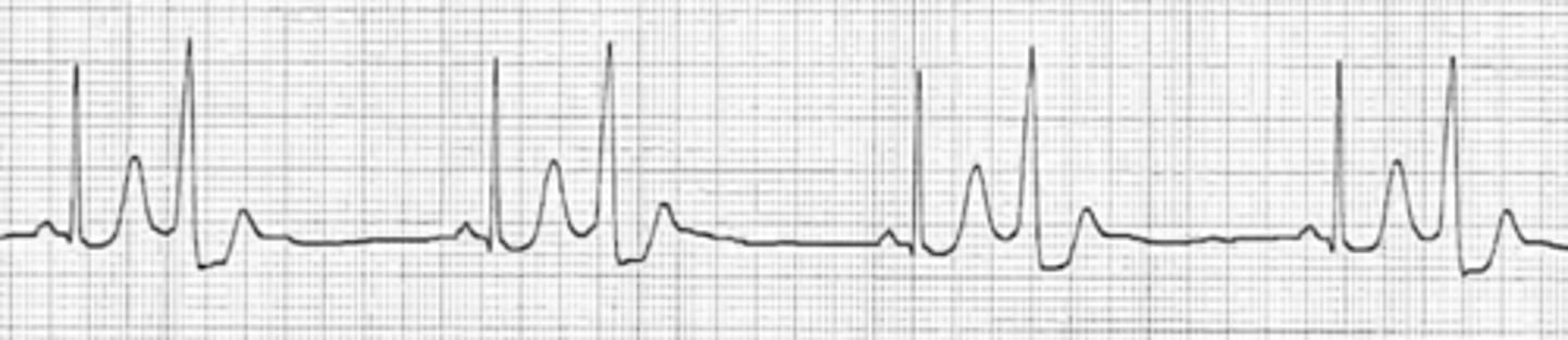 <p>Name the rhythm</p>