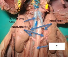 <p>What is the arrow pointing to? What’s it function? </p>