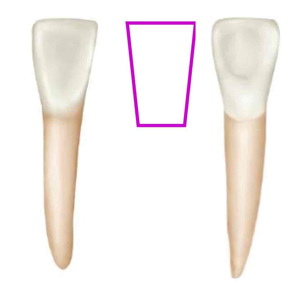 <p>what is the GEOMETRIC outline for the labial and lingual view of the mandibular right lateral incisors?</p>