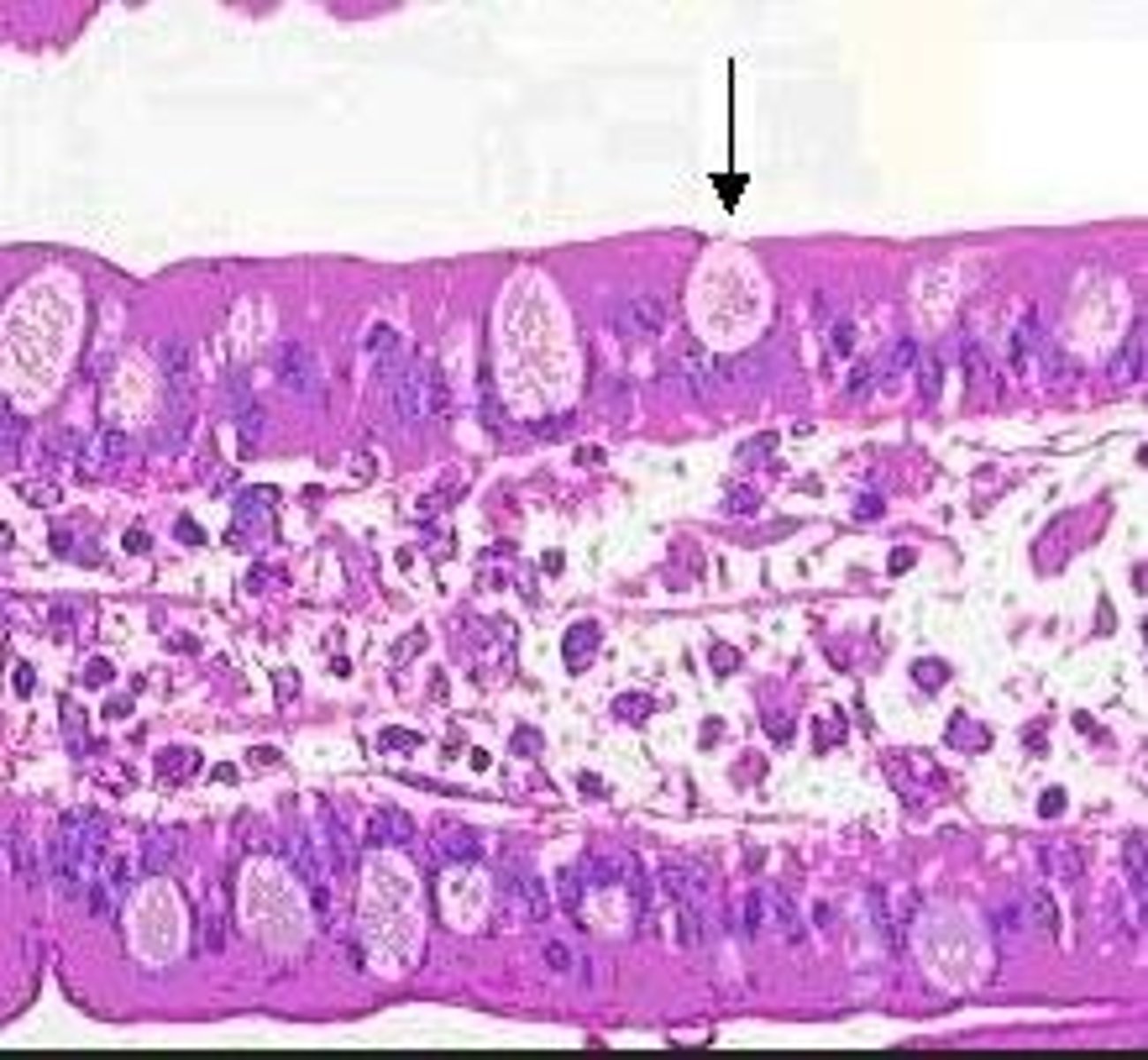 <p>Mucus-producing cell found in simple columnar epithelium and pseudostratified ciliated columnar epithelium</p><p>(cell is indicated by arrow)</p>