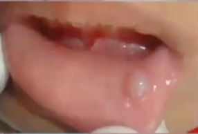 <p>diagnosis?</p>