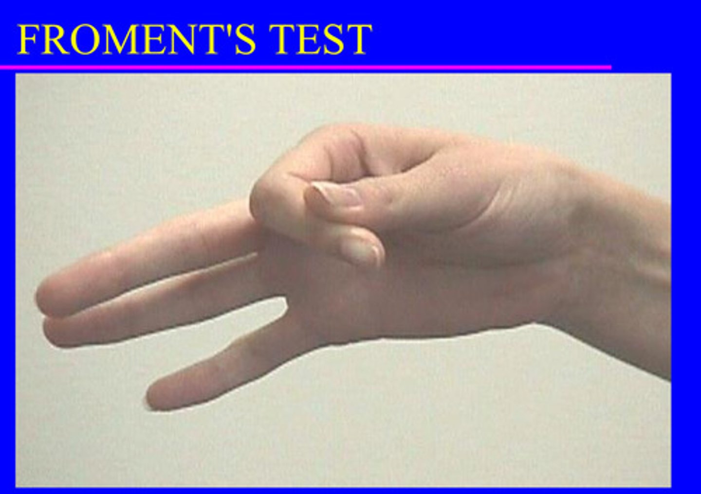 <p>Seated</p><p>Adducts thump to the tip of the index finger</p><p>Place paper between the fingers and resist allowing the paper to be pulled form the grip of the index finger and thumb</p>