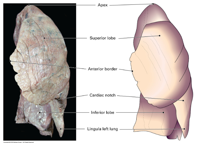 <p><span style="color: var(--ic-brand-font-color-dark)">The&nbsp;</span><strong>oblique fissure</strong><span style="color: var(--ic-brand-font-color-dark)">&nbsp;separates the&nbsp;</span><strong>inferior lobe</strong><span style="color: var(--ic-brand-font-color-dark)">&nbsp;from the&nbsp;</span><strong>superior lobe.&nbsp;</strong></p>