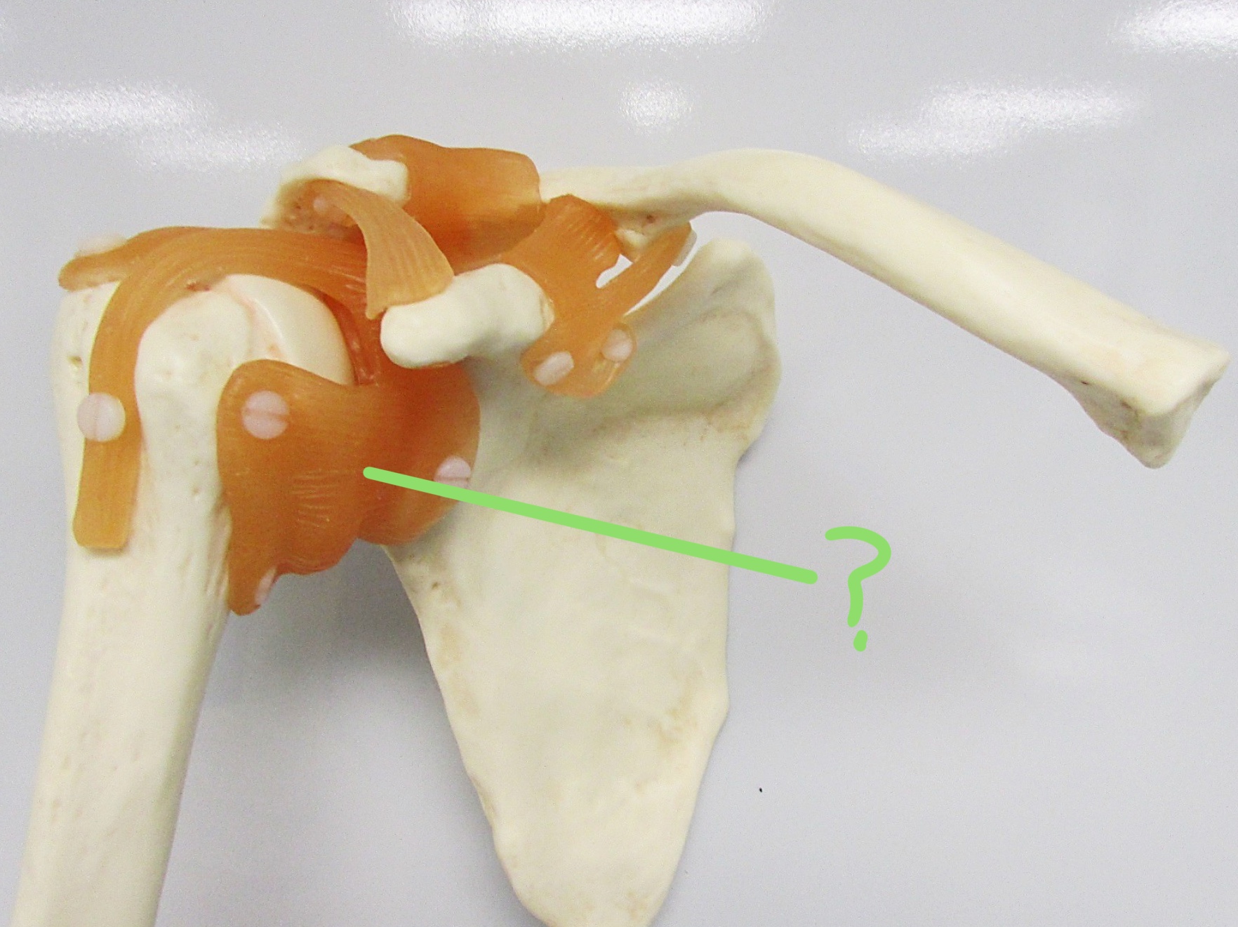 <p>Determine the part of the shoulder joint highlighted</p>