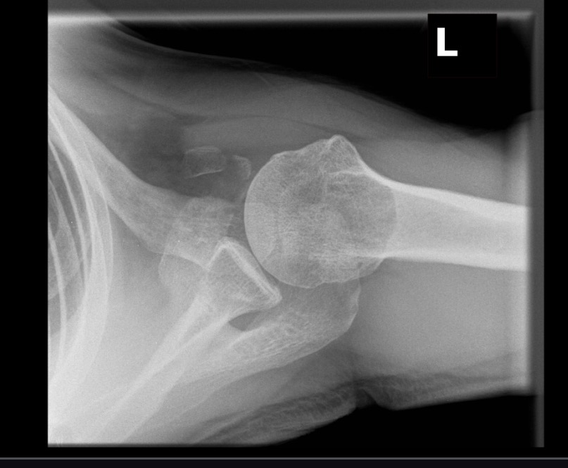 <p>What projection position is this image?</p>