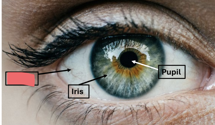 <p>white outer layer of eye</p><ul><li><p>dense CT</p></li></ul><p></p>