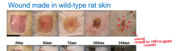 <p>cells migrate inwards to close wound</p>