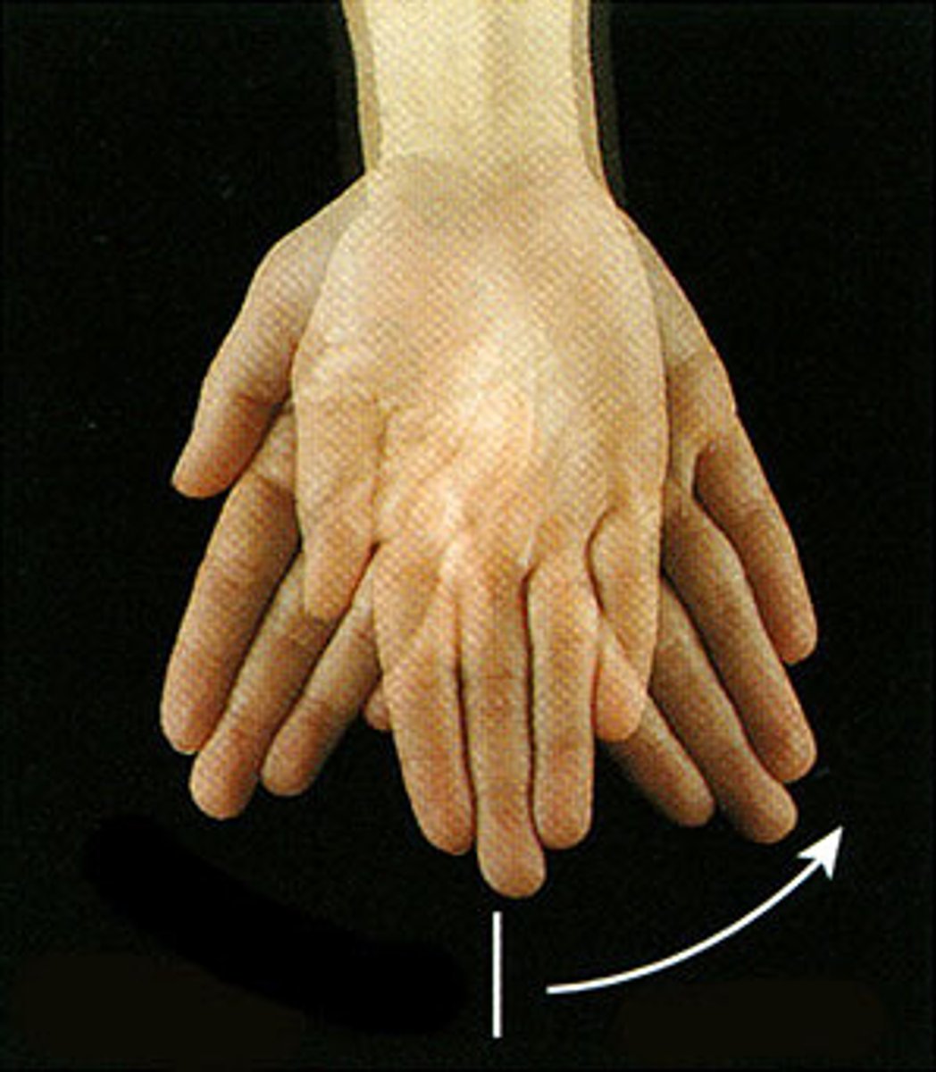 <p>Movement of the wrist towards the ulna or medial side</p>