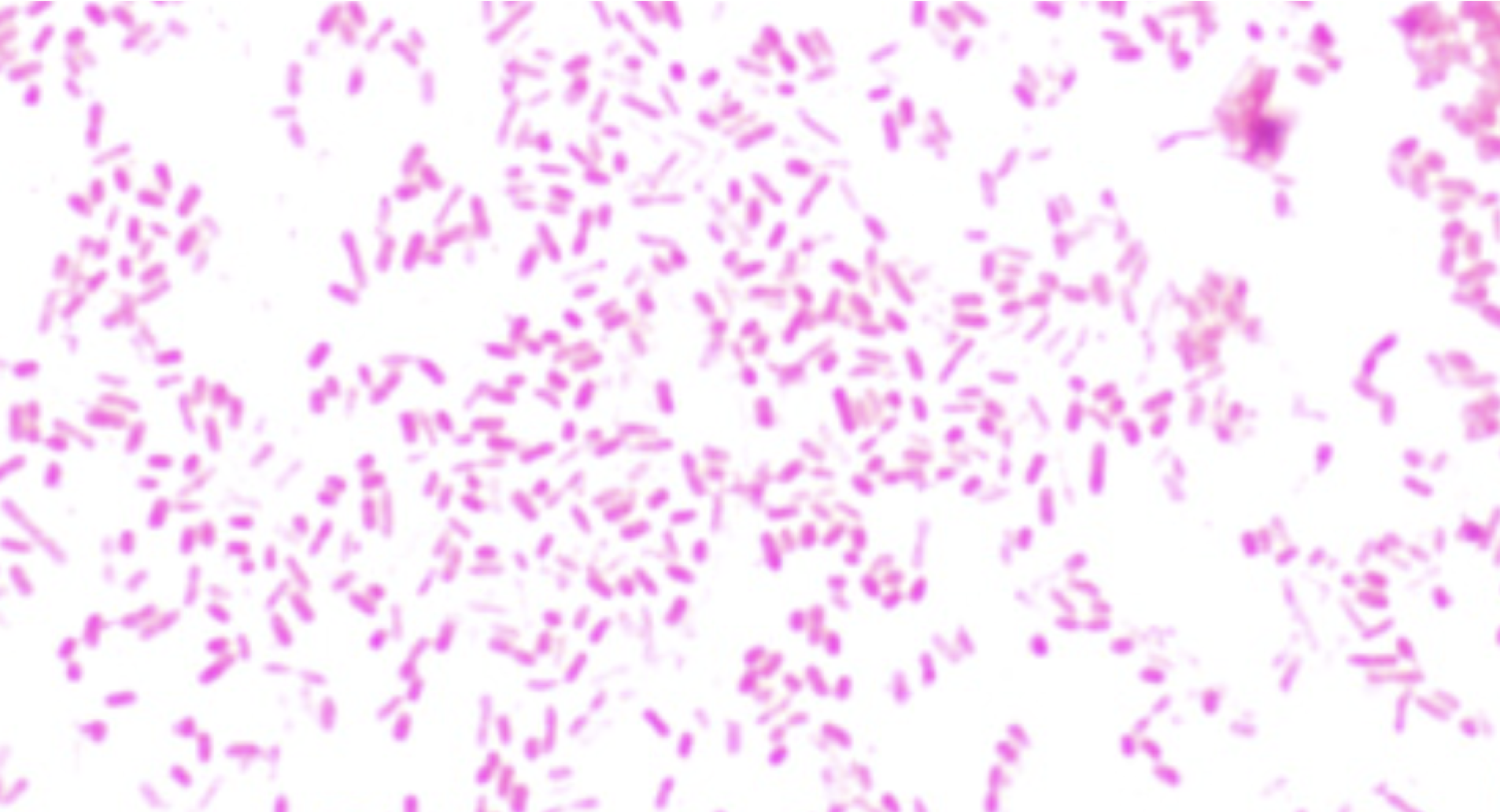 <p><span style="color: rgb(246, 246, 246);"><span>S. aureus or E. coli</span></span></p>