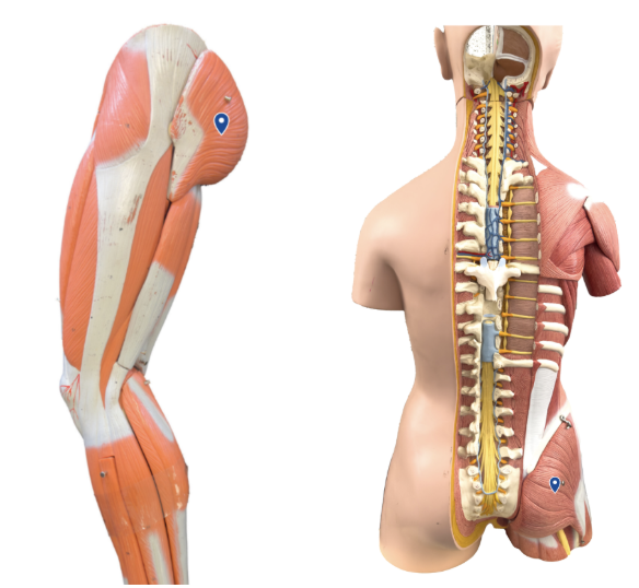 <p>What muscle is the arrow pointing to?</p>