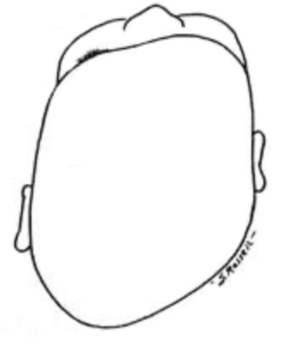 <p>Plagiocephaly will be opposite of the side of torticollis.</p><p>Ex</p><p>R torticollis = L plagiocephaly</p>