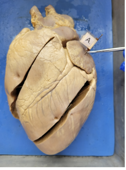 <p>the left atrium </p>