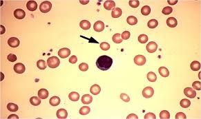<p>What is this red cell exhibiting?</p>