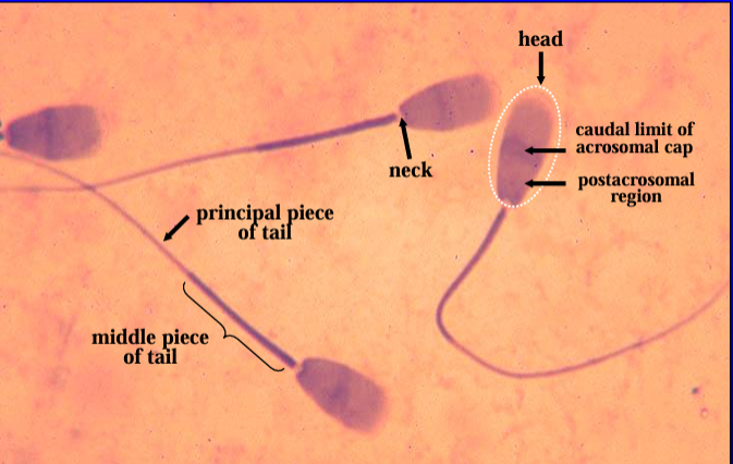 <p>Bovine spermatozoa. </p><p>The <strong>head</strong> contains the nucleus, acrosomal cap, and postacrosomal region. </p><p>The <strong>neck </strong>is the narrow constriction that connects the head and the tail. </p><p>The <strong>middle piece</strong> and <strong>principal piece of tai</strong>l can be identified in all three spermatozoa seen in this figure</p>