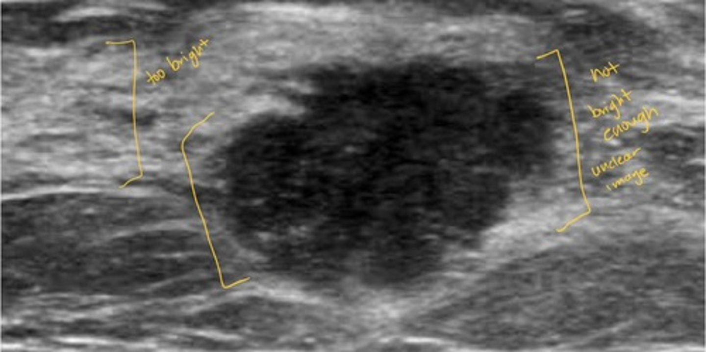 <p>Producing echoes of lower amplitude than normal for the surrounding medium</p><p>portions of an image that are not as bright as surrounding tissues, or tissues that appear less bright than normal</p>