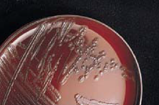 <p>Cardiobacterium: C. hominis: Biochemicals:</p>