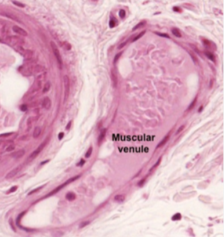 <p>Is this an artery, vein, or capillary?</p>