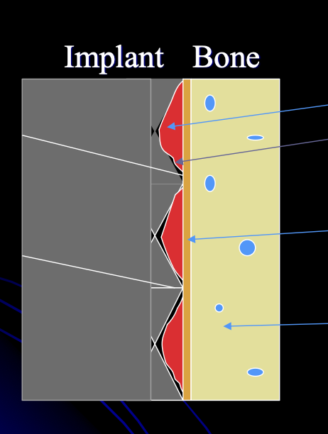 <p>Thermal and mechanical trauma</p><ol><li><p>Hematoma</p></li><li><p>Necrotic zone</p></li><li><p>Minor inflammatory response</p></li></ol><p></p>