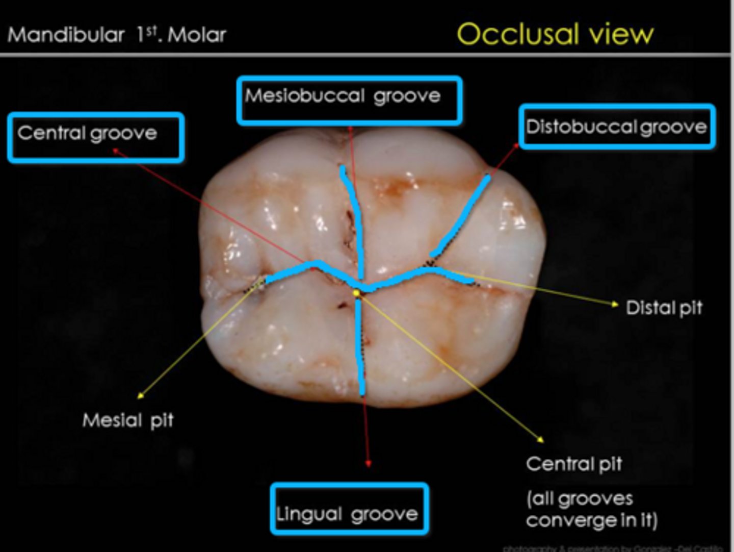 <p>1. central groove</p><p>2. mesiobuccal groove</p><p>3. distobuccal groove</p><p>4. lingual groove</p>