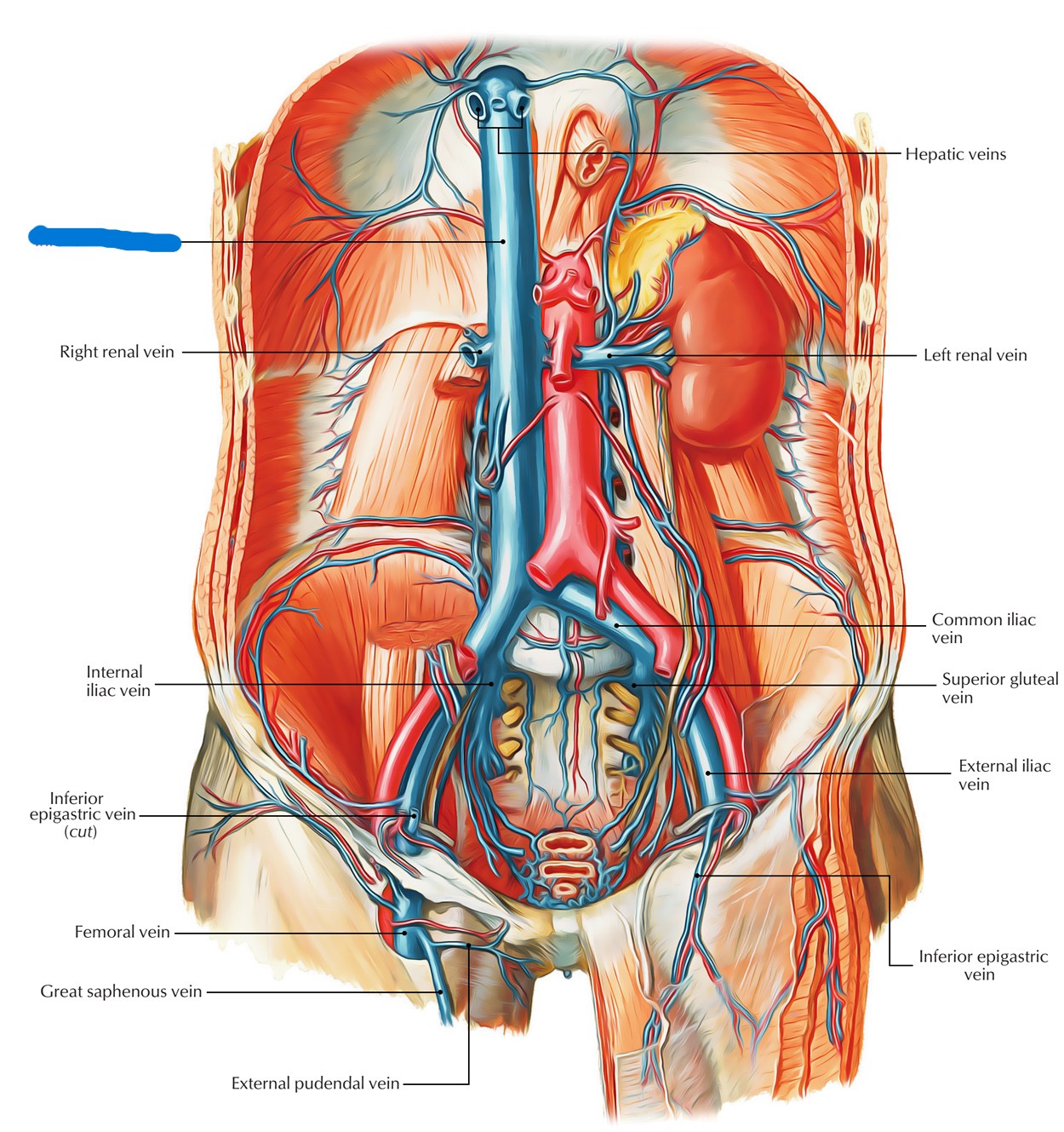 term image