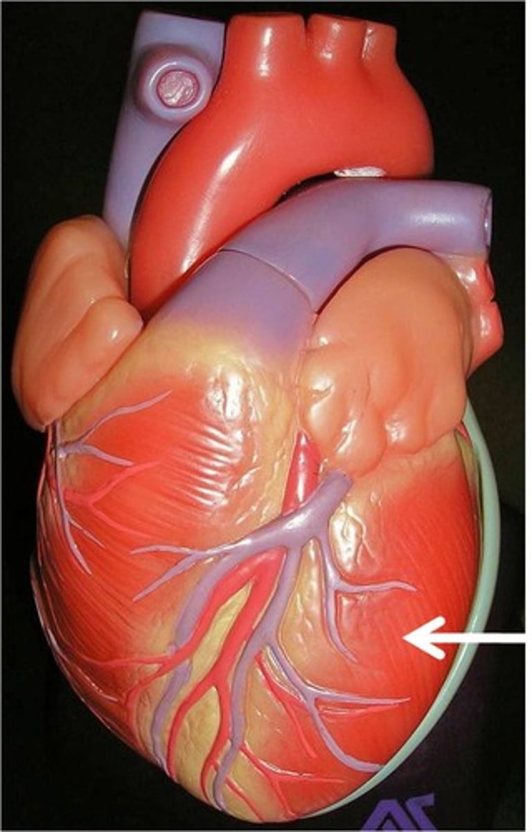 <p>Chamber. TA pinches bottom left.</p>