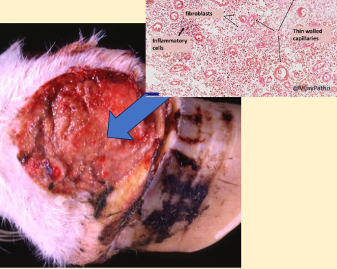 <p>Based on the diagram and its appearance, what is the lesion indicated in the photo formed by?</p>