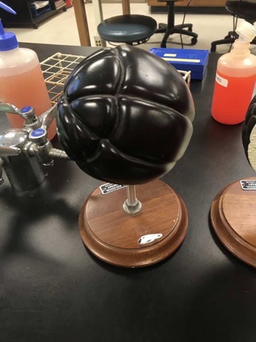 <p>For the following model, give the following:</p><p>1) stage of embryonic development</p>