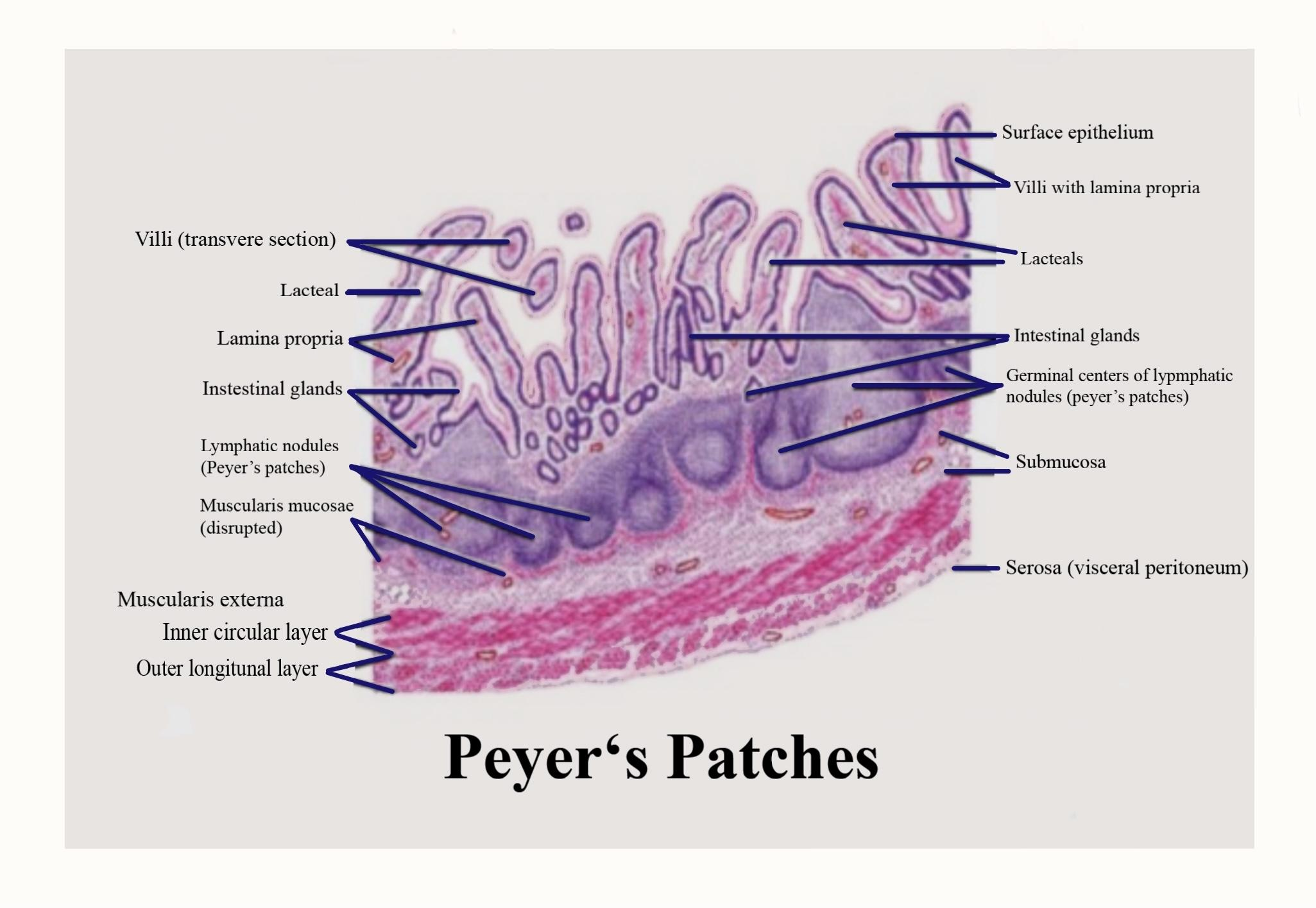 <p>Which of the following lymphoid organs is NOT matched with its function?</p><table style="min-width: 25px;"><colgroup><col style="min-width: 25px;"></colgroup><tbody><tr><td colspan="1" rowspan="1" style="margin: 0px; padding: 0.3em; position: relative;"><p>spleen: remove old red blood cells</p></td></tr><tr><td colspan="1" rowspan="1" style="margin: 0px; padding: 0.3em; position: relative;"><p>thymus: site of T cell maturation</p></td></tr><tr><td colspan="1" rowspan="1" style="margin: 0px; padding: 0.3em; position: relative;"><p>bone marrow: form lymphocytes</p></td></tr><tr><td colspan="1" rowspan="1" style="margin: 0px; padding: 0.3em; position: relative;"><p>Peyer's patches: site of B cell maturation</p></td></tr></tbody></table><p></p>