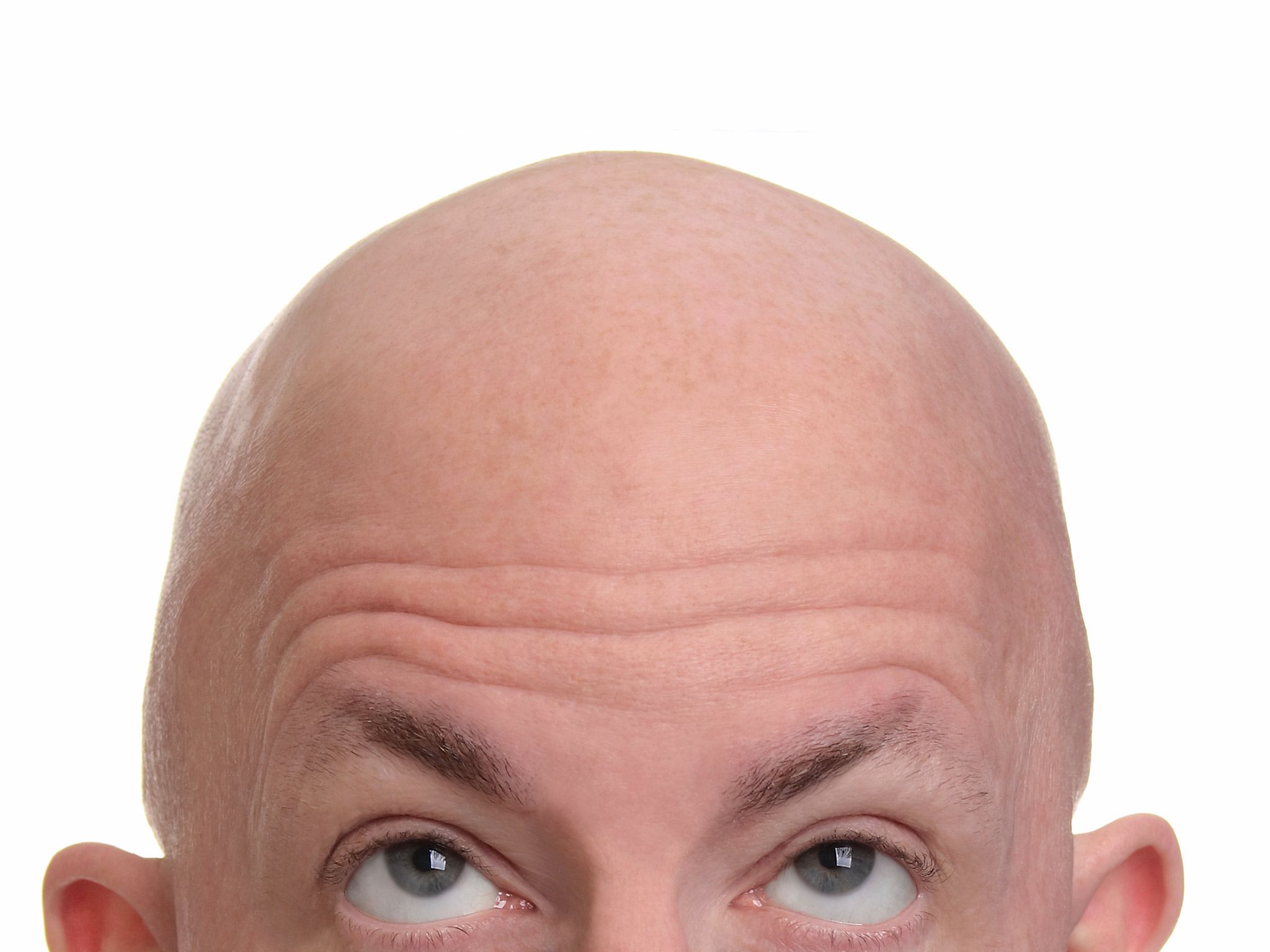 <p><span>bald</span></p>