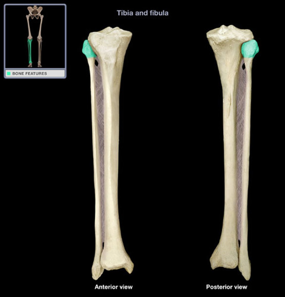 <p>proximal end, top of the fibula</p>