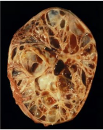 <p>What is this condition and associated clinical signs</p>