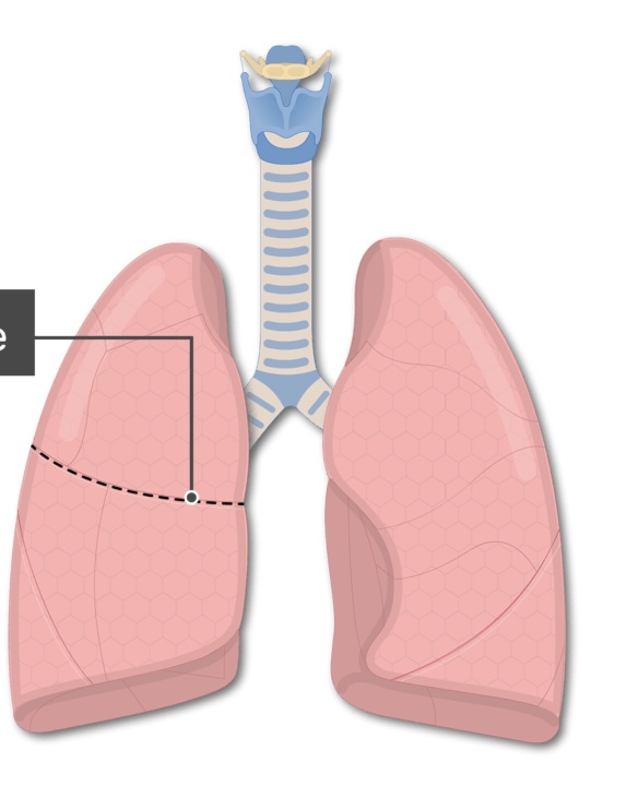 <p>The fissure that separates the superior lobe from the middle lobe of the right lung is known as the <strong><em></strong></em>__.</p>