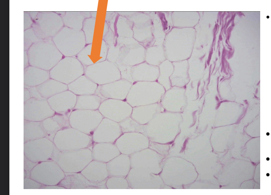 <p>what tissue is this</p>
