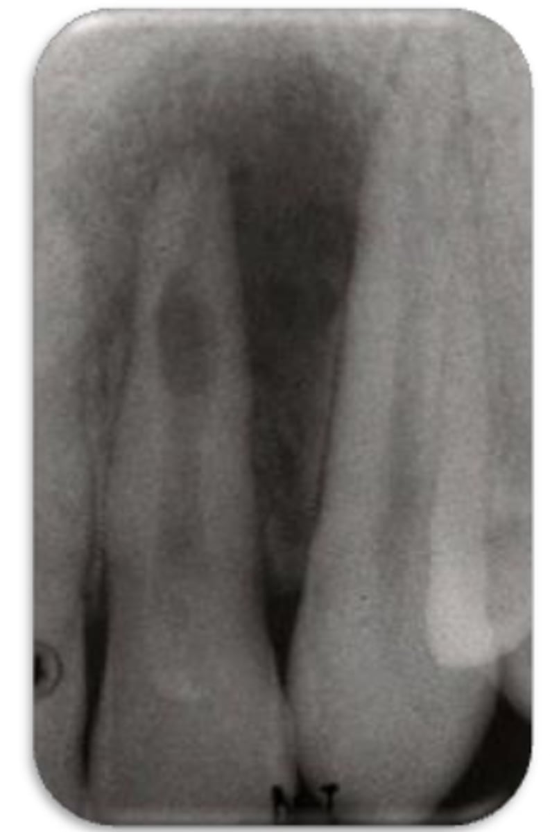 <p>ID the problem:</p>