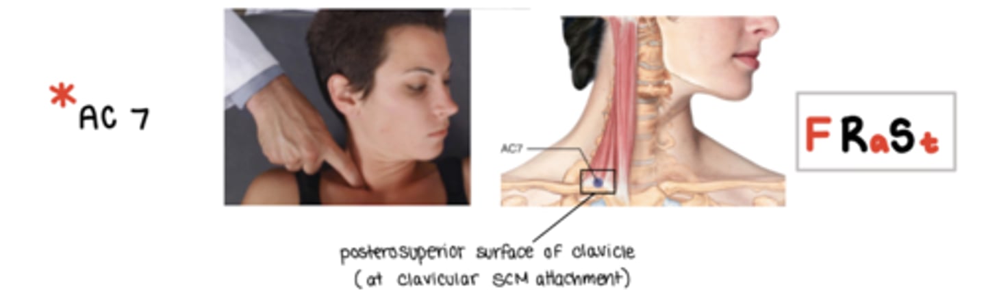 <p>F Ra St</p><p>lucky number 7</p><p>on the posterosuperior surface of the clavice at the clavicular attachment of the SCM</p>