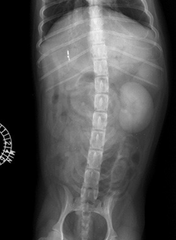 <p>A contrast study of this organ is called what?</p>
