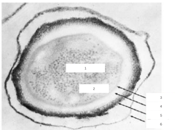 <p>What are the parts of the endospore shown?</p>